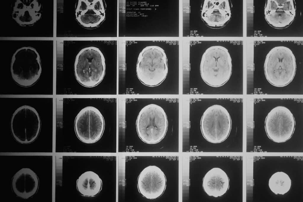 a collage of x-ray images of the brain